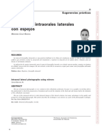 Fotografías Intraorales Laterales Con Espejos: Sugerencias Prácticas