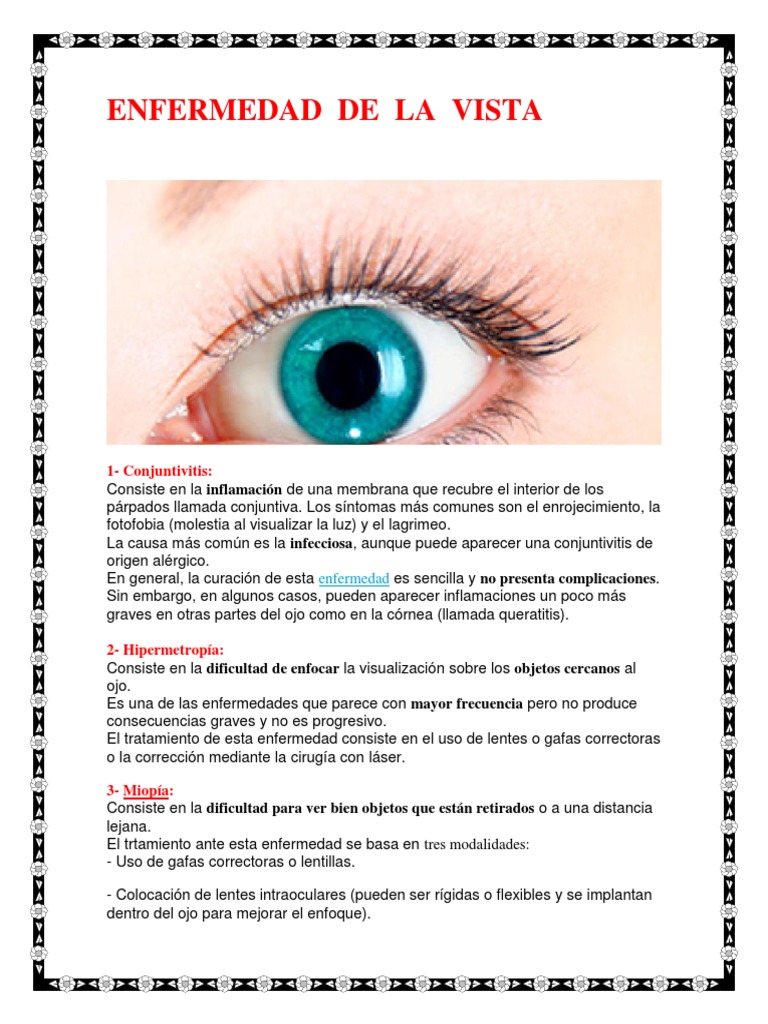 Enfermedad De La Vista: 1-Conjuntivitis | Ojo humano | Ojo