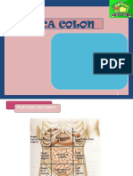 Ca Colon: Case Report