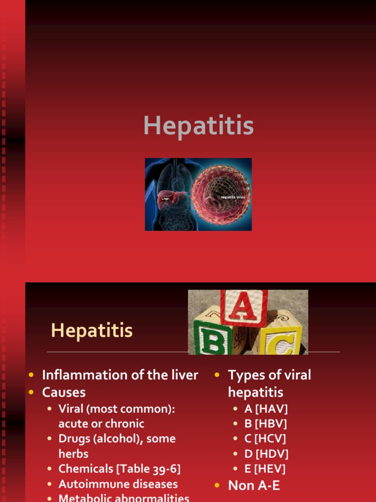 presentation of hepatitis
