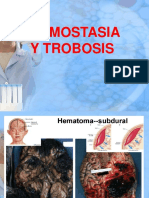 Hemostasia y Trobosis