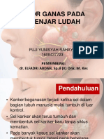 Tumor Ganas Kelenjar Saliva