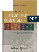 almir ignacio da nóbrega - manual de tomgrafia computadorizada