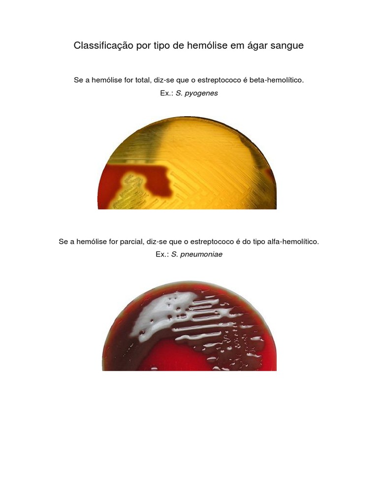 Classificação de Hemólise em Ágar Sangue | PDF