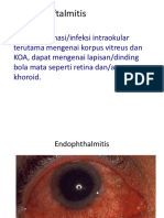 Endophthalmitis Treatment Guide