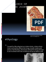 Tuberculosis of Bones and Joints
