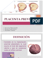 Placenta Previa