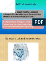 Definisi Endometriosis