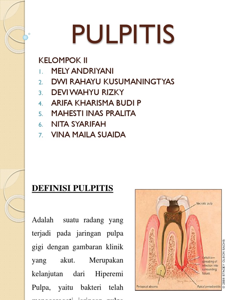 Pulpitis | PDF