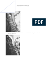 Crossectional Patologi: I. Spine 1. Fraktur Odontoid