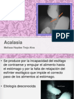 Acalasia 140213195225 Phpapp01