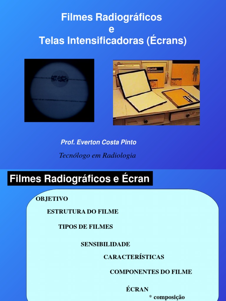 A Curva Característica De Um Filme Radiográfico Mostra
