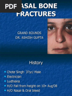 Nasal Bone Fractures: Grand Rounds Dr. Ashish Gupta