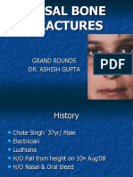 Nasal Bone Fractures: Grand Rounds Dr. Ashish Gupta