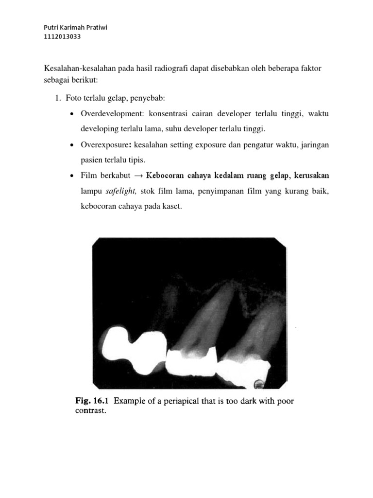 Kesalahan Foto Pada Hasil Radiografi | PDF