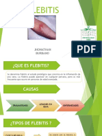 Flebitis: causas, tipos y tratamiento