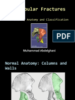 Acetabular Fractures