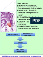 Mielofibrosis Hemato