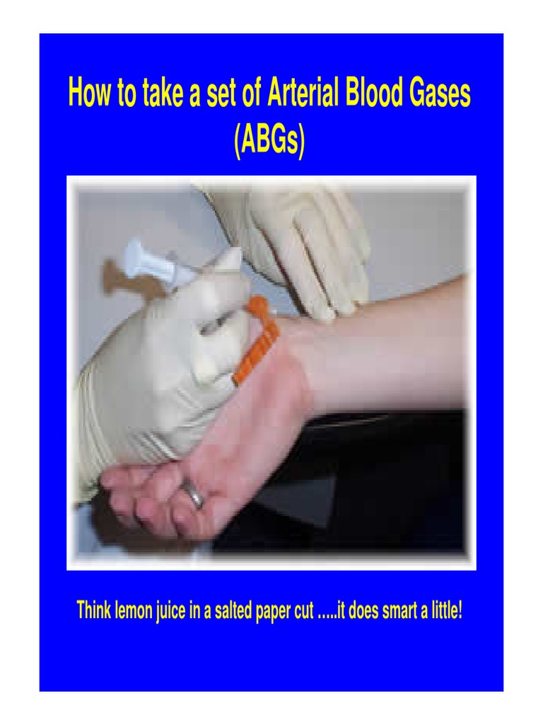 How To Take A Set of Arterial Blood Gases (Abgs) : Think Lemon Juice in ...