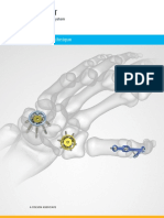 Acumed Surgical Technique Modular Hand System HNW00 04 A PDF