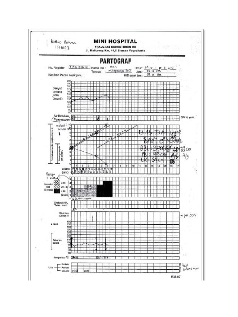 Contoh Partograf | PDF