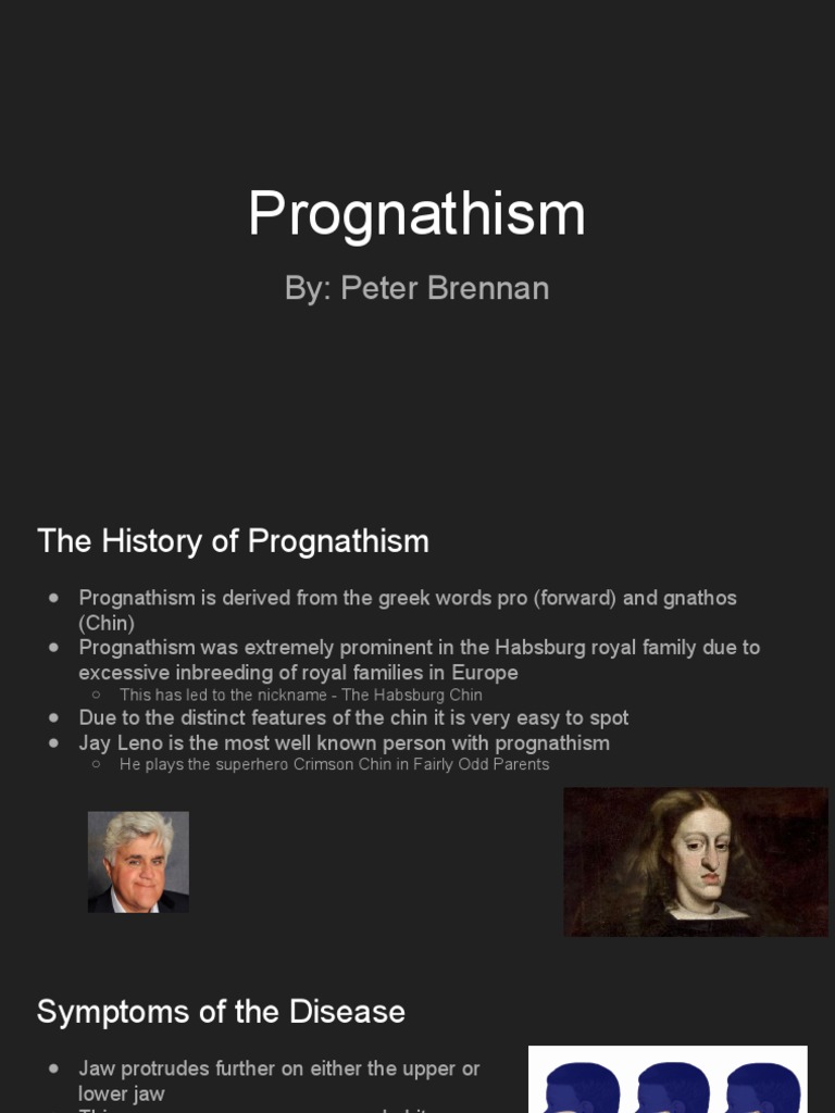 The Habsburg Chin PDF Clinical Medicine Medicine