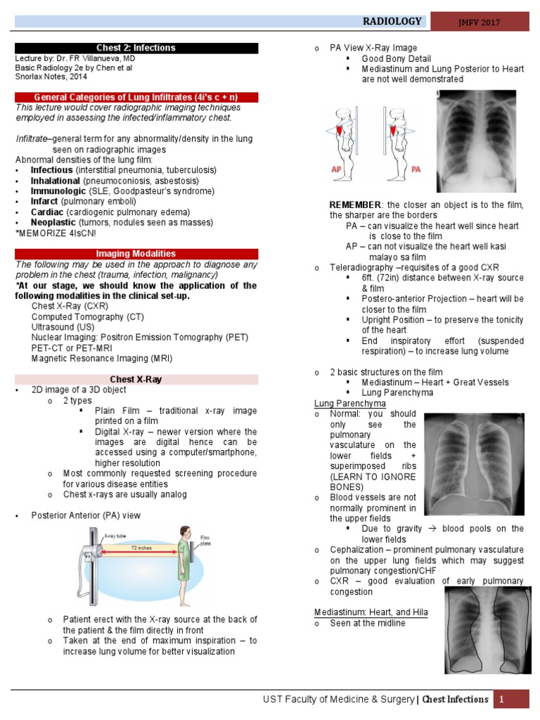 Lec 4 Chest 2 Infections | PDF | Medical Imaging | Ct Scan