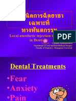 Local Anesthetic Injection Techniques in Dentistry