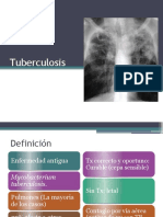 Tuberculosis