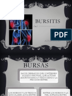 Bursitis