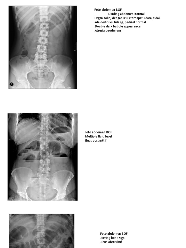Presentation Abdomnal X Ray Dan Jawaban Repaired