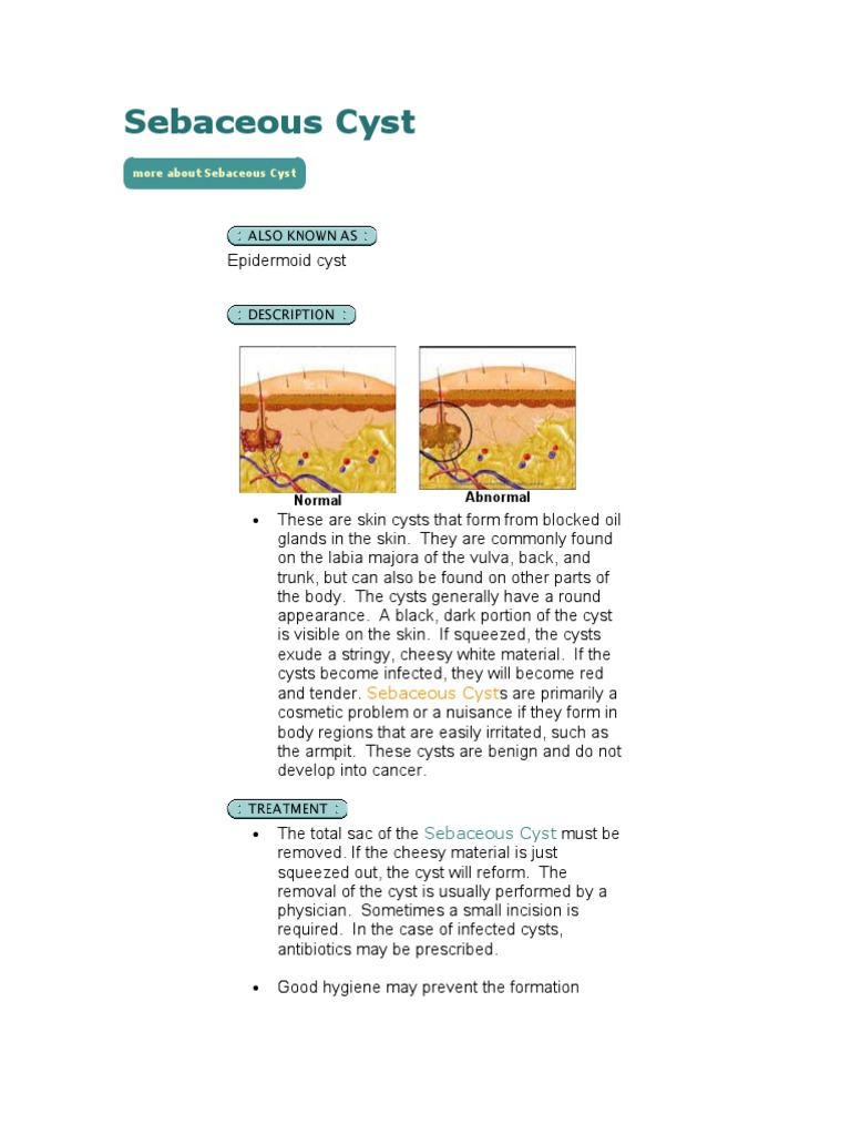 Sebaceous Cyst Medical Specialties Clinical Medicine