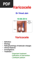 Varicocele: DR Vinod Jain