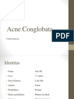 Acne Conglobata