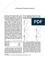 Posterior Fixation Sutures Weaken Rectus Muscles Progressively