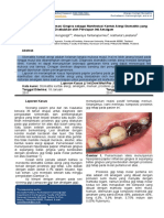 Allergic Contact Stomatitis Caused by Dental Amalgam