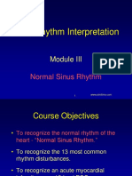 Module3 Normal Sinus Rhythm