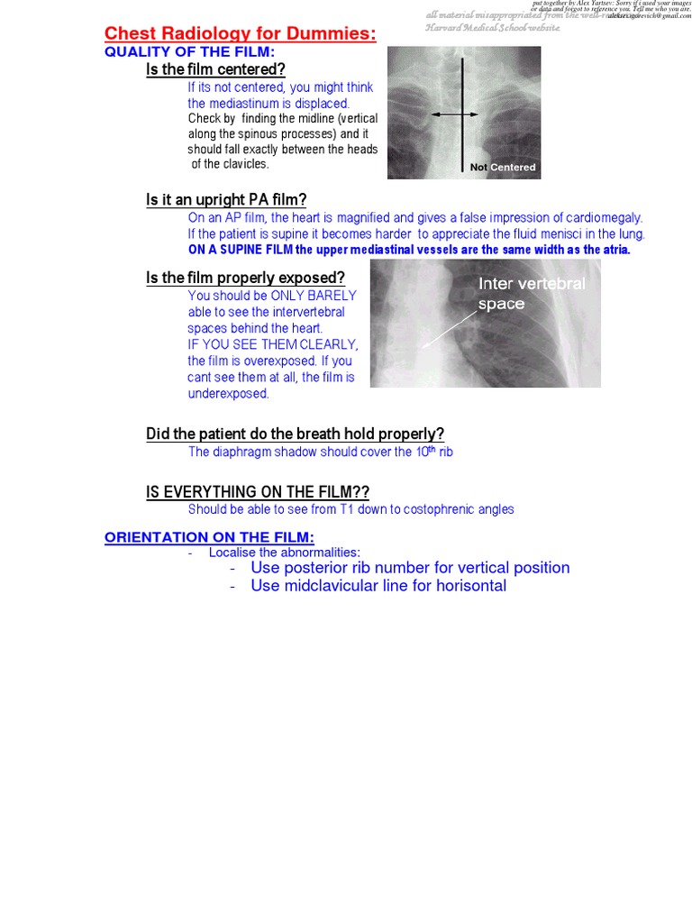 Chest Radiology For Dummies PDF PDF Lung Thorax