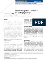 Central Serous Chorioretinopathy A Review of