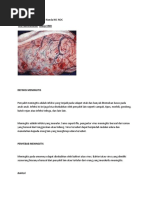 askep pjb nic noc Lp Meningitis
