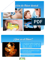 Aplicación de Flúor Dental