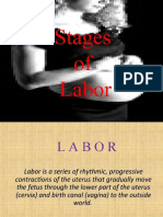 Stages of Labor