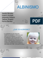 Albinism o