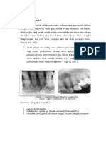 Abses Periapikal Dan Abses Submandibula