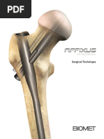 AFFIXUS Hip Fracture Nail Surgical Technique