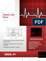 Ecg Anormal