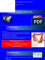 Enfermedad Diverticular