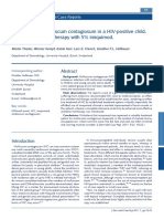 Disseminated Molluscum Contagiosum in A HIV-positive Child. Improvement After Therapy With 5% Imiquimod