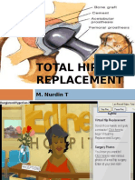 Total Hip Replacement