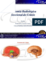 Anatômia Radiológica Seccional Do Crânio PDF